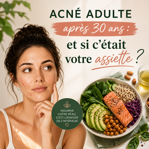 Acné adulte après 30 ans : et si c'était votre assiette ?